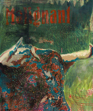 Vusi Beauchamp; Malignant