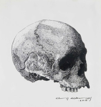 Christiaan Diedericks; Skull