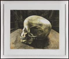 Walter Oltmann; Child Skull B