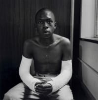 David Goldblatt; Fifteen-year-old Lawrence Matjee after his assault and detention by the Security Police, Khotso House, De Villiers Street