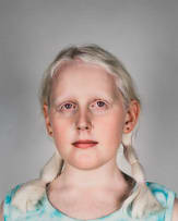 Pieter Hugo; Danielle Lawrence, United Kingdom, 2003, Portraits of Albino's Series