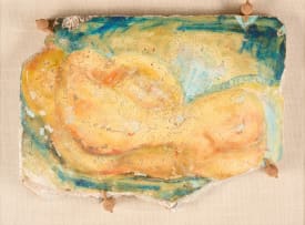 Alexis Preller; Shrapnel Wounds