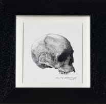 Christiaan Diedericks; Skull