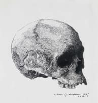 Christiaan Diedericks; Skull